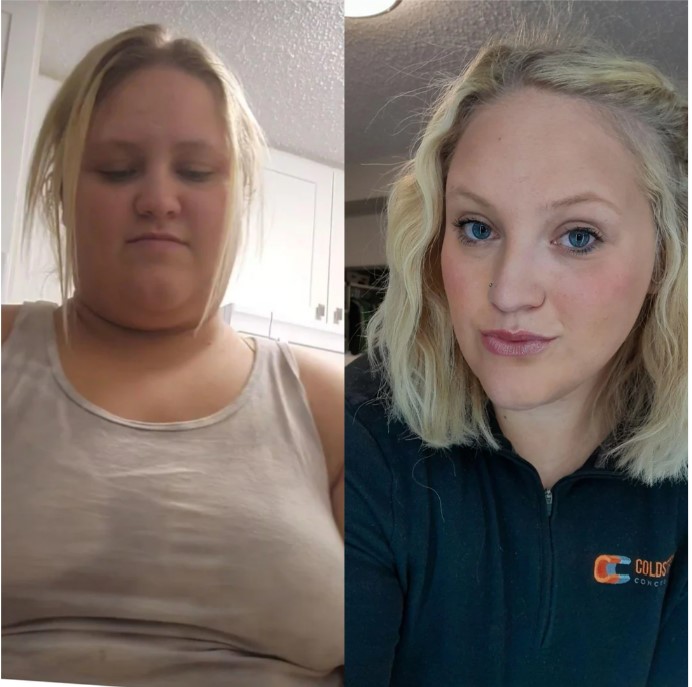 3. weight loss before and after pictures